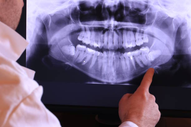 Best Emergency Root Canal Treatment in Winnetka, IL